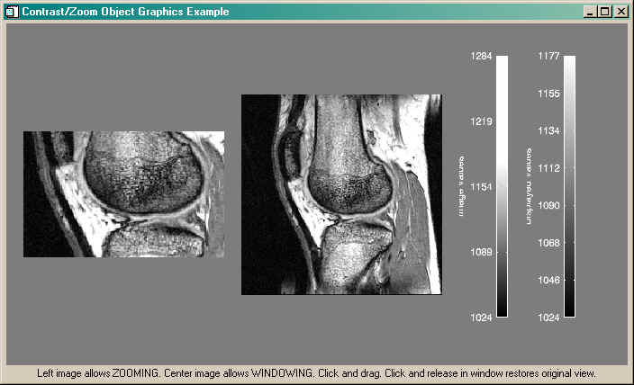 An interactive research tool for viewing DICOM images.