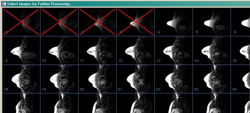 A medical imaging tool for selecting images for further processing.