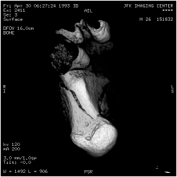 The CT image displayed in Hounsfield units.