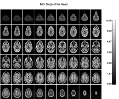 Multiple Image Plot