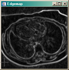 The ActiveContour edgemap.