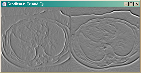 The ActiveContour edgemap.