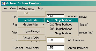 The ActiveContour Adjustments menu.