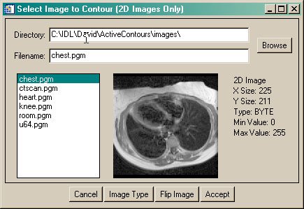 The image selection tool in ActiveContour.