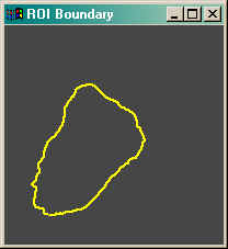 ROI boundary obtained from the Find_Boundary program.